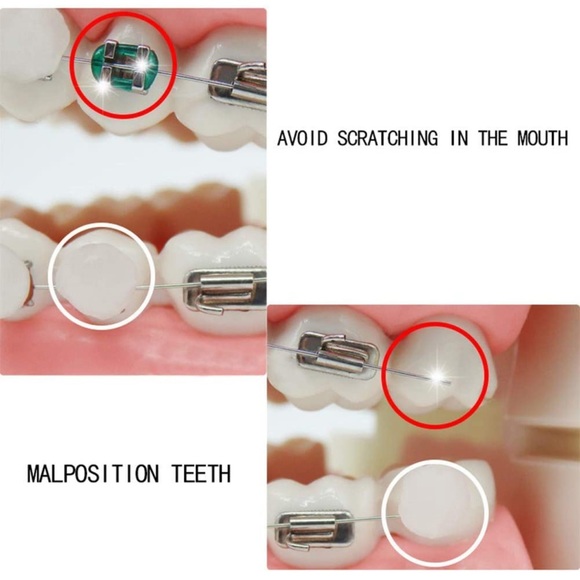 NEW Dental Oral Care Orthodontics Wax with Fruit Flavor for Brace Wearers 10Pack - Picture 3 of 7